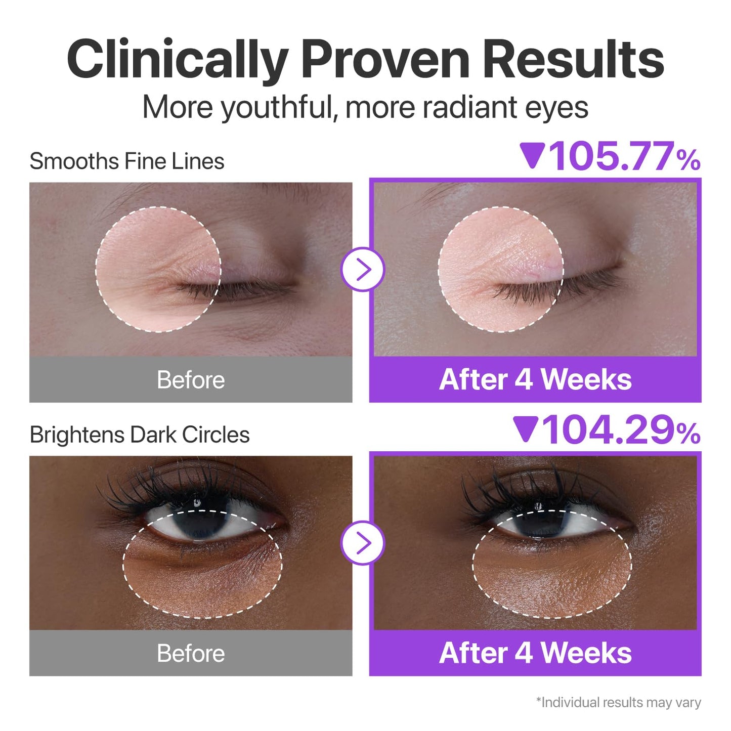 NAD+ Retinol Eye Cream | Korean Eye Cream for Dark Circles, Puffiness, Fine Lines & Wrinkles with 50 Peptides, Niacinamide & Ceramides