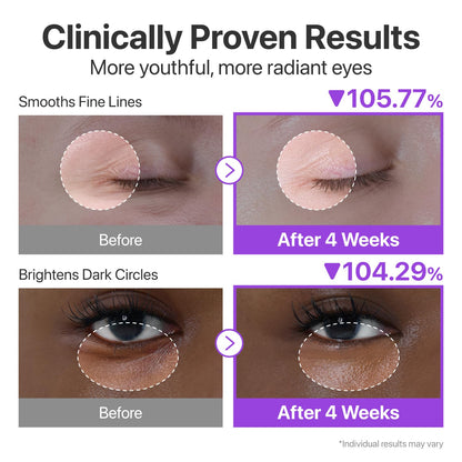 NAD+ Retinol Eye Cream | Korean Eye Cream for Dark Circles, Puffiness, Fine Lines & Wrinkles with 50 Peptides, Niacinamide & Ceramides